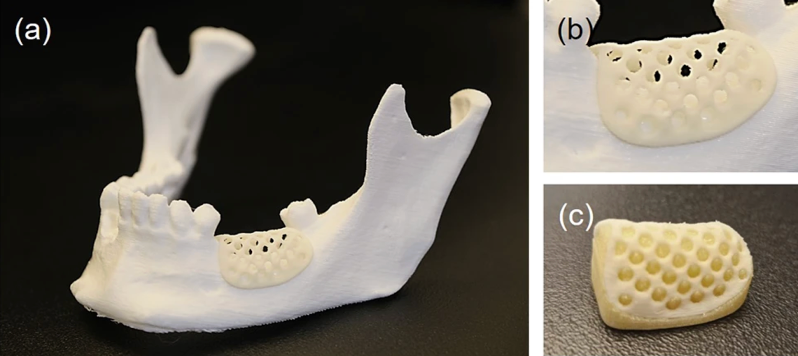 Printed to Perfection: 3D Printed Bone Grafts – Current Happenings ...
